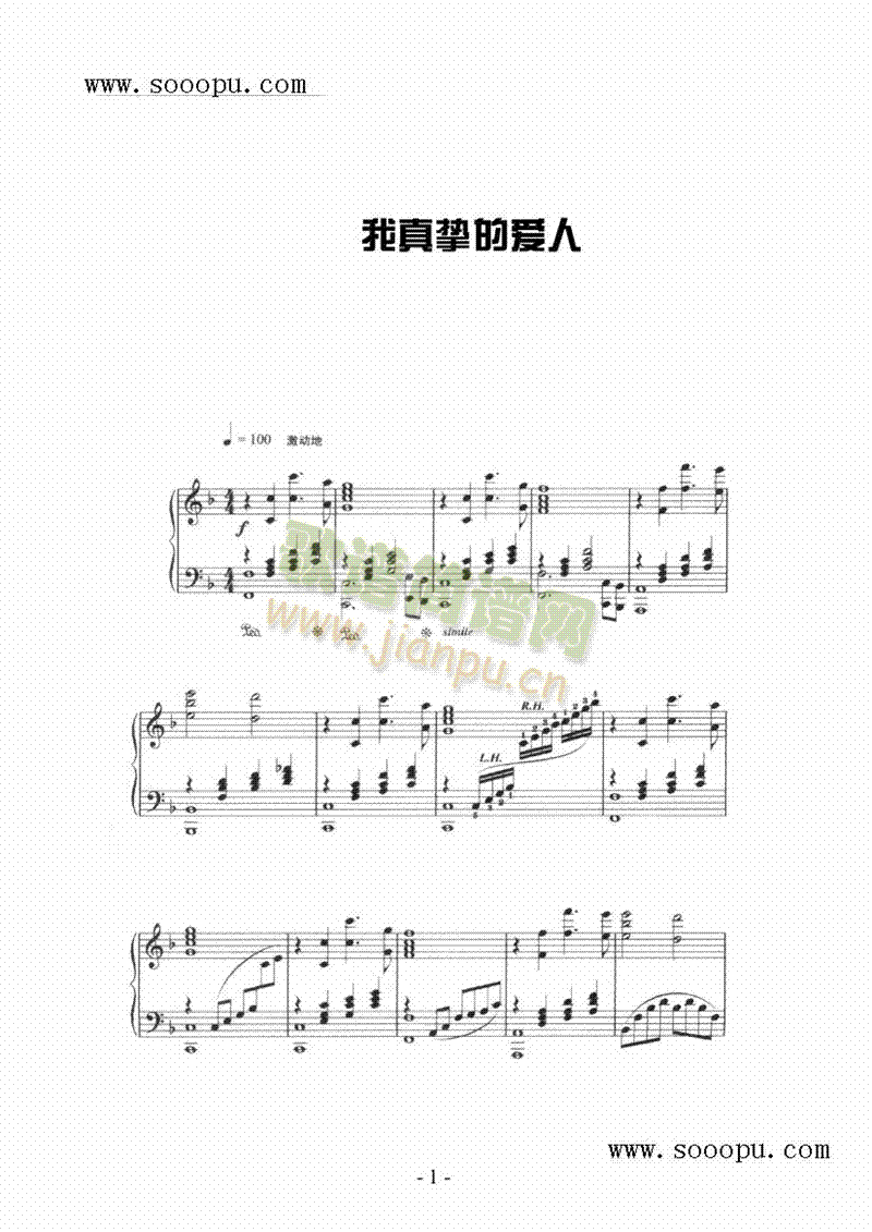 擴Đ(i)IP((l)V)1