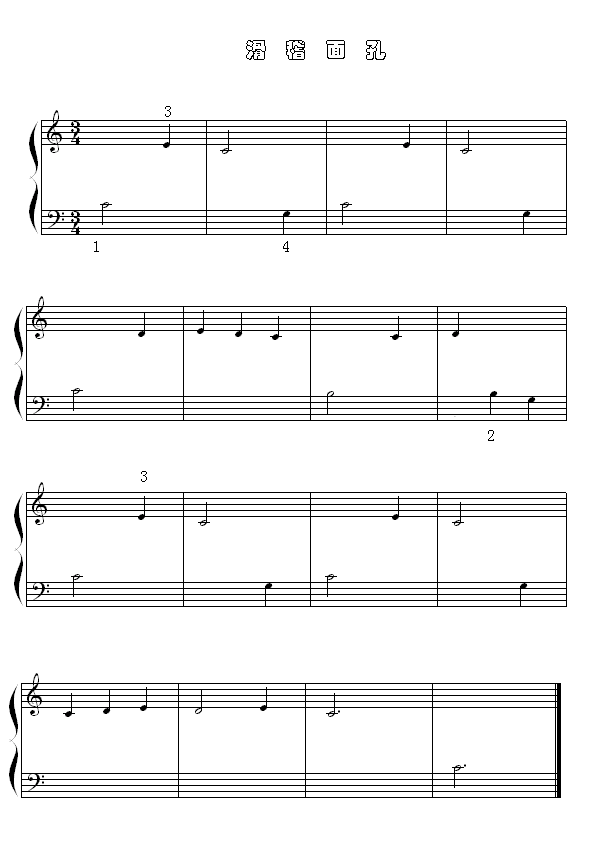 (V)1